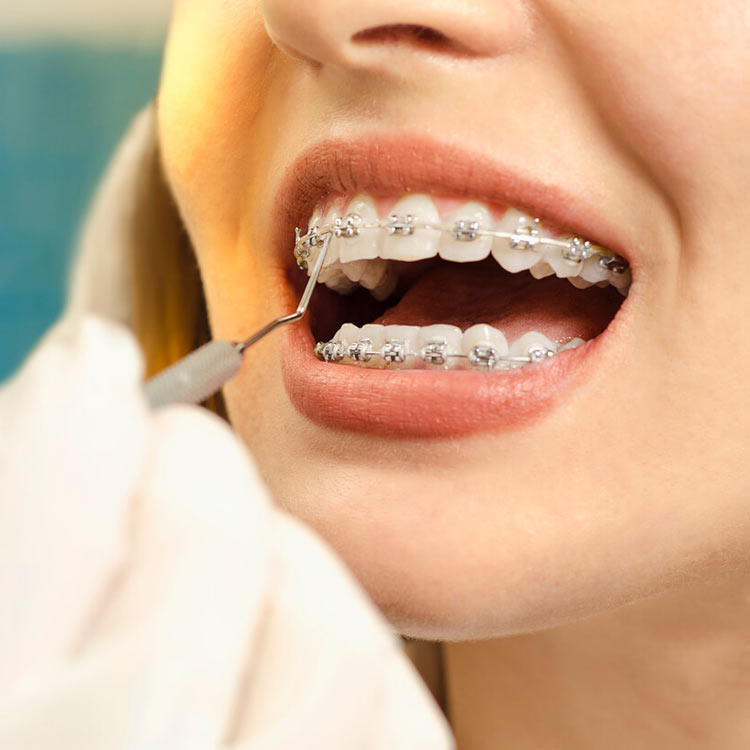 orthodontic solutions