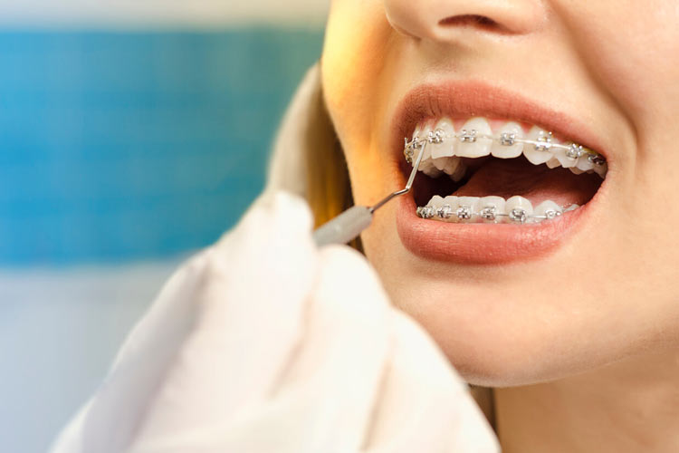 orthodontic solutions